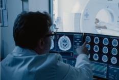 Image of doctor looking at MRI scans