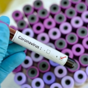 Image of positive coronavirus test in vile